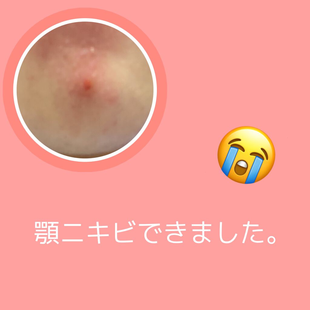 ゼロスポットシカクリーム/Today’s Cosme/フェイスクリームを使ったクチコミ（1枚目）