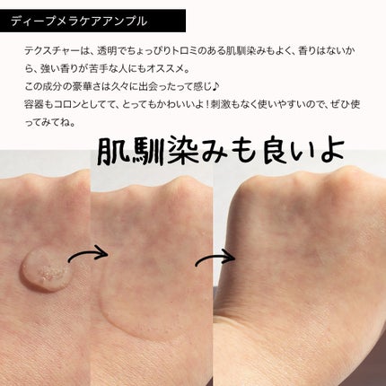 コスザッカ on LIPS 「\出会ってしまった!ブライトニングの大本命かも!?/刺激なく確..」(5枚目)