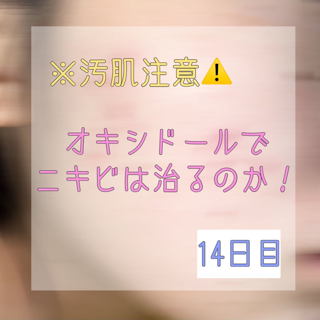 オキシドール(医薬品)/日本薬局方/その他を使ったクチコミ(1枚目)