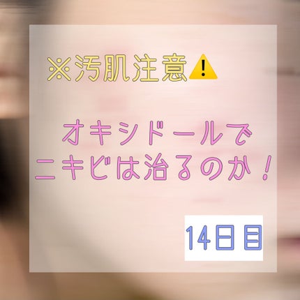 オキシドール(医薬品)/日本薬局方/その他を使ったクチコミ(1枚目)