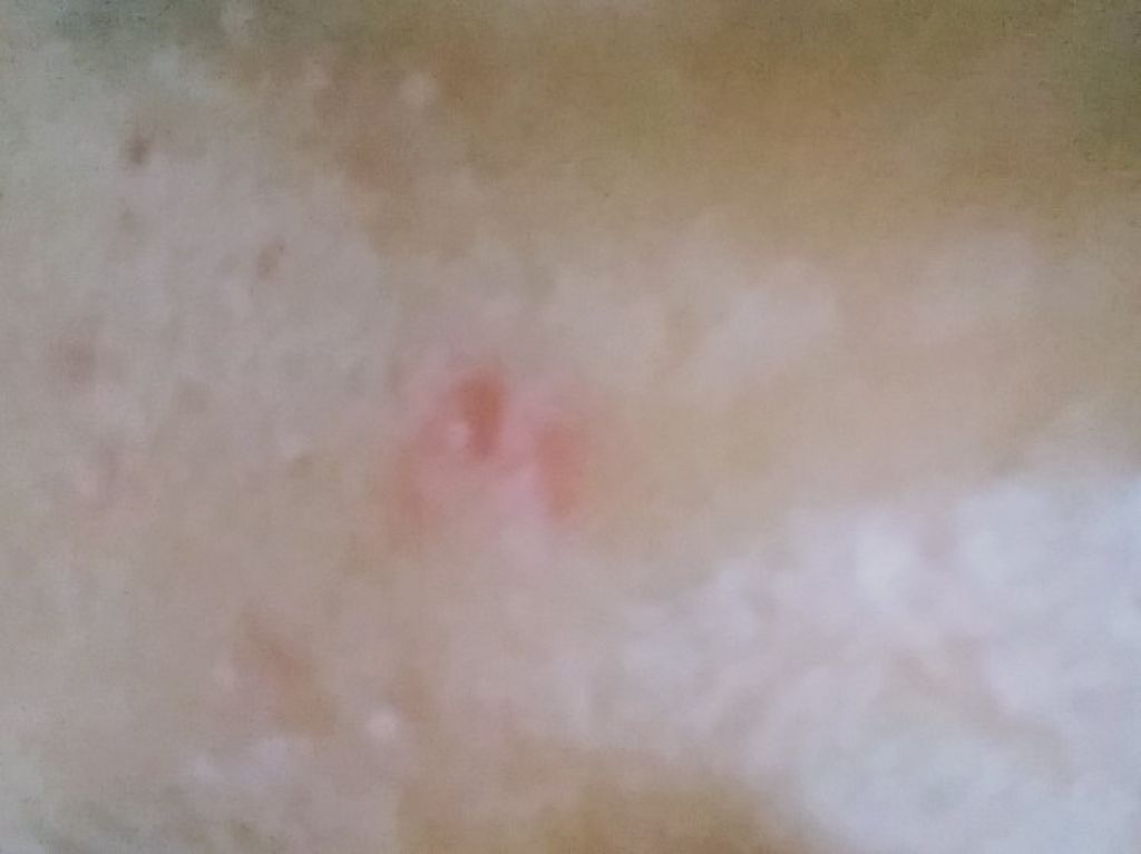 薬用パウダー化粧水/メンソレータム アクネス/化粧水を使ったクチコミ(2枚目)