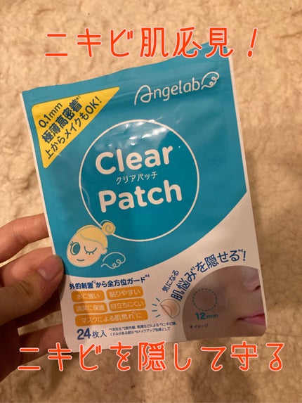 クリアパッチ/Angelab/にきびパッチを使ったクチコミ(1枚目)