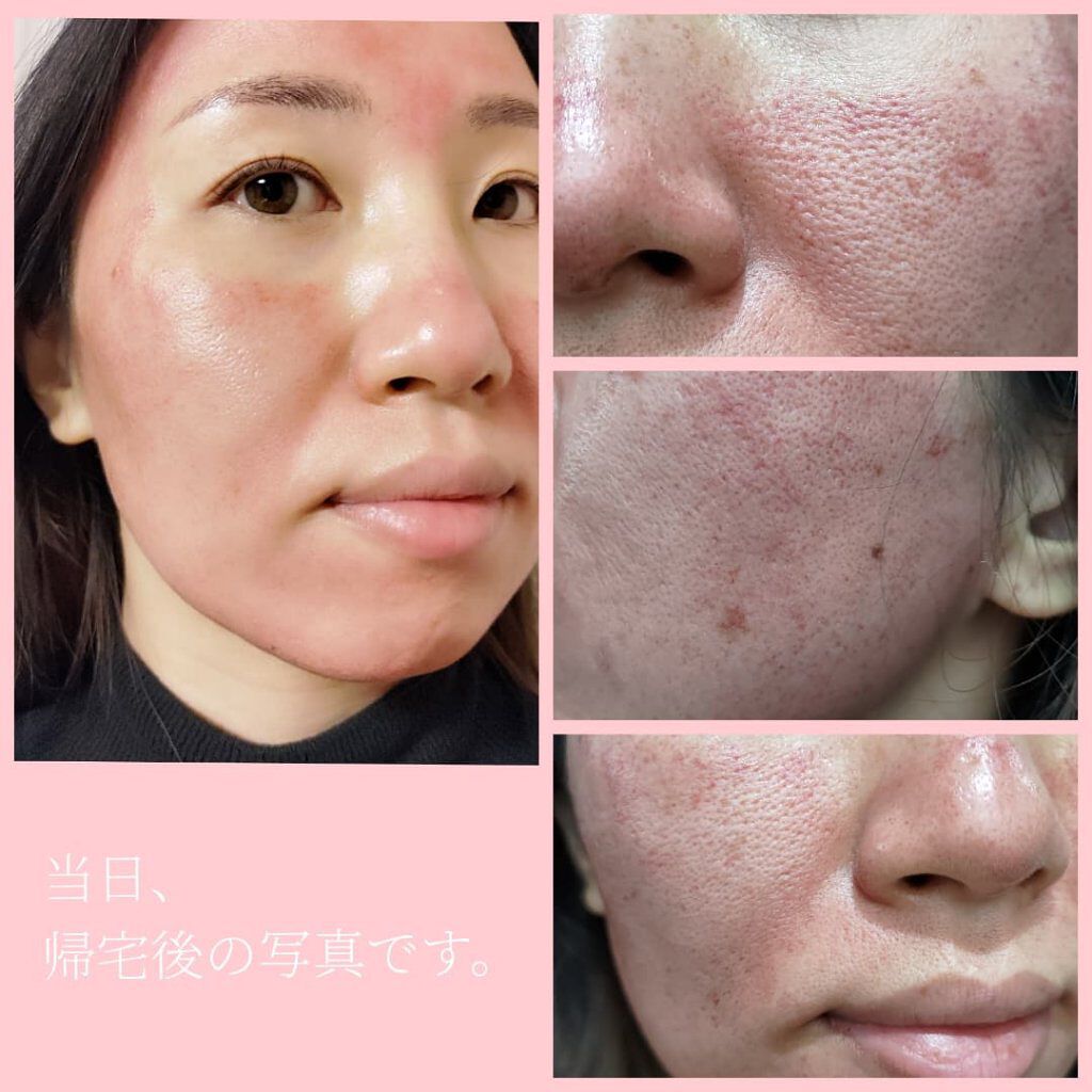 を使ったクチコミ（2枚目）