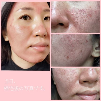 を使ったクチコミ(2枚目)