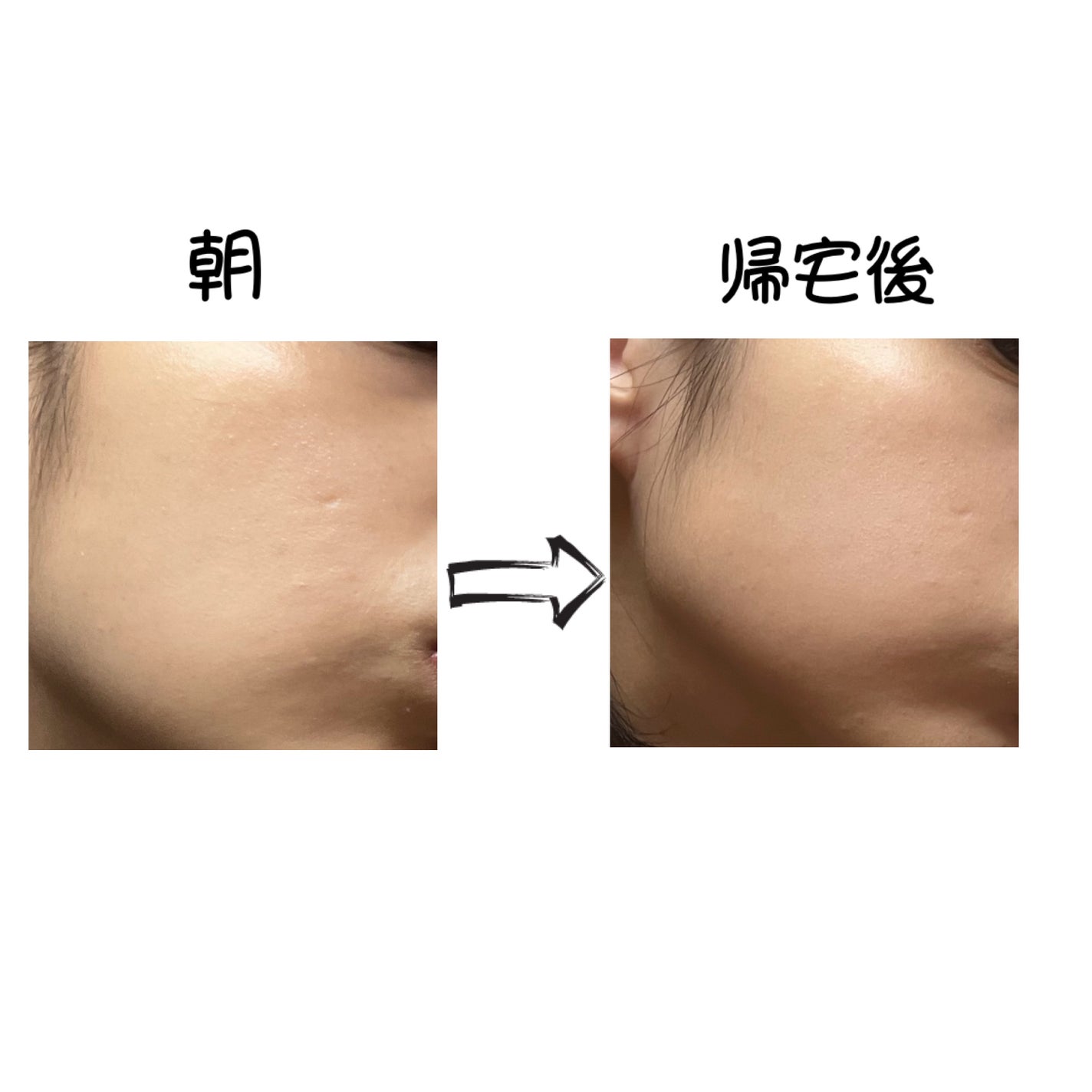 ãã©ããã£ãã¯ãšãã»ã³ã¹ãªããã/ããã¢ãŒãžã¥/ãªããããã¡ã³ããŒã·ã§ã³ã䜿ã£ãã¯ãã³ãïŒ2æç®ïŒ