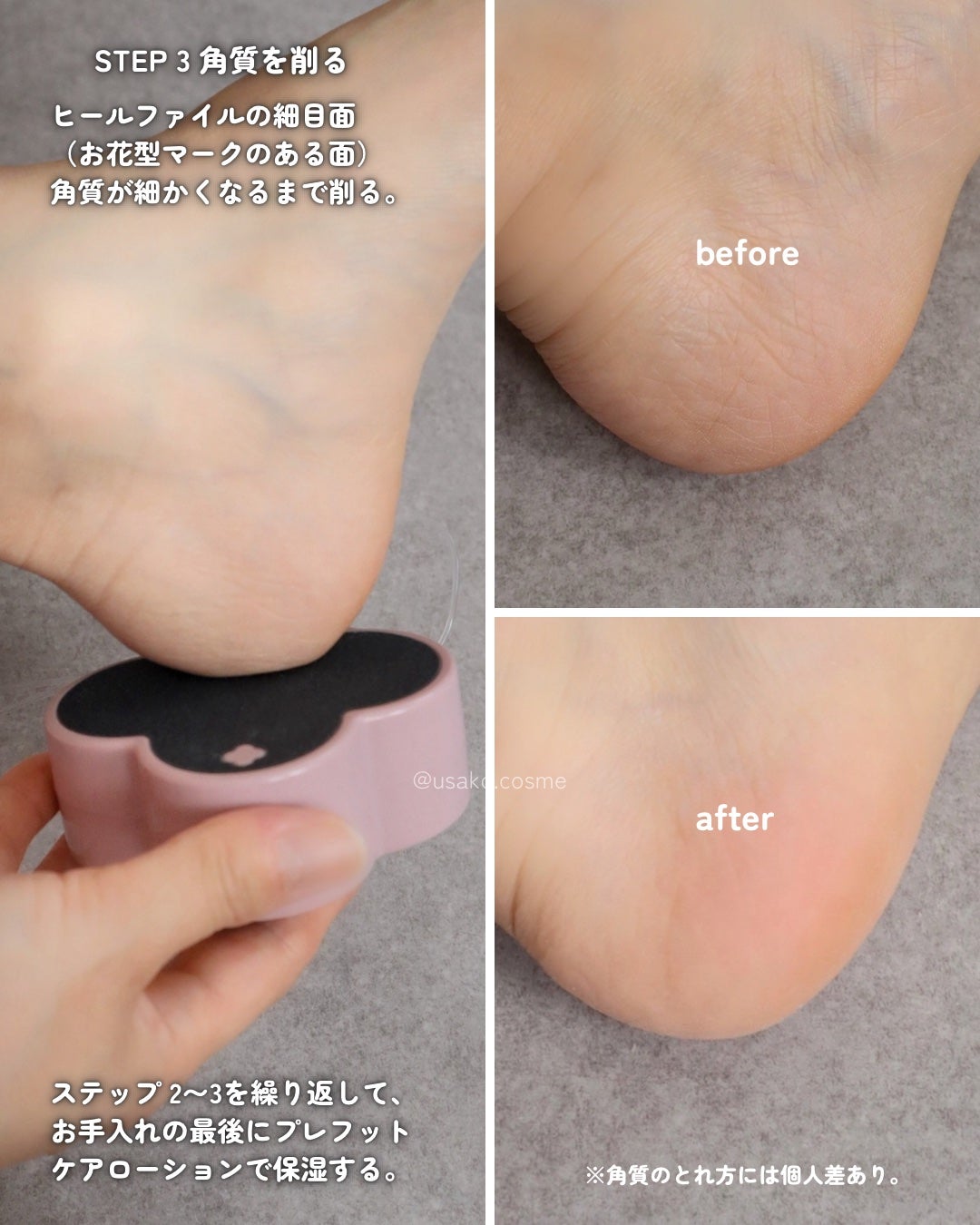 KOBAKO フットケアキット2(ピンクグレージュ)/KOBAKO/その他キットセットを使ったクチコミ(5枚目)