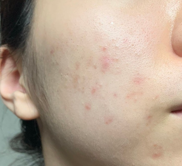 EGFアランテノールクリーム/CELLINSHOT/フェイスクリームを使ったクチコミ（3枚目）