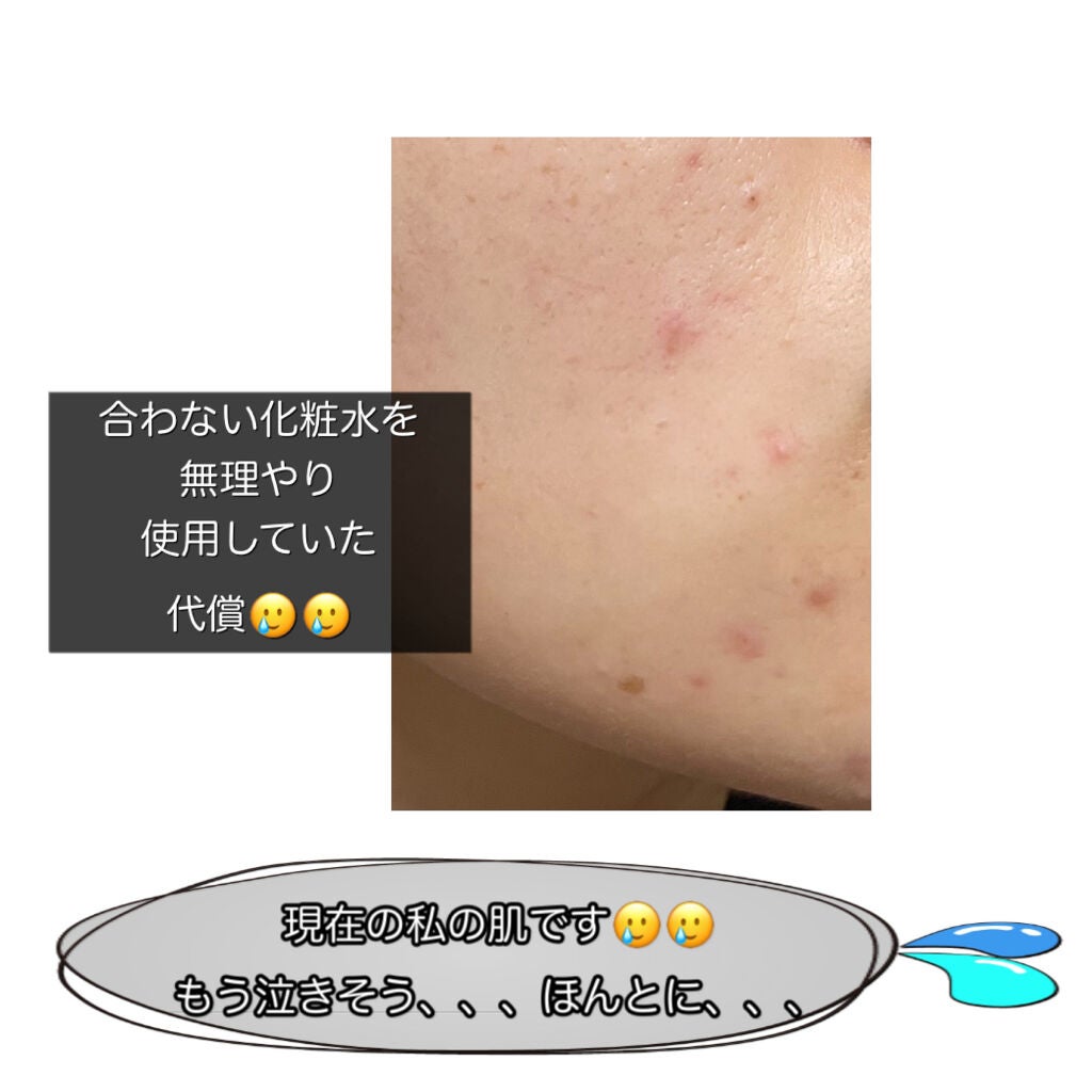 スキンケアセット(とてもしっとり)/IHADA/トライアルキットを使ったクチコミ(6枚目)