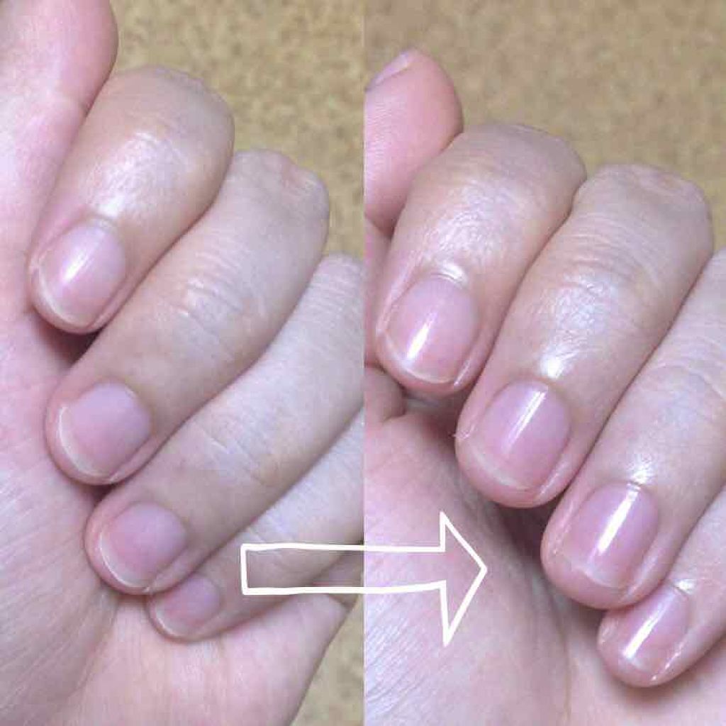 エテュセ クイックケアコート/ettusais/ネイルオイル・トリートメントを使ったクチコミ(2枚目)