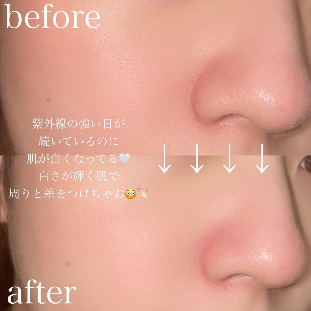 スノーセル/メディタミン/美容サプリメントを使ったクチコミ(3枚目)