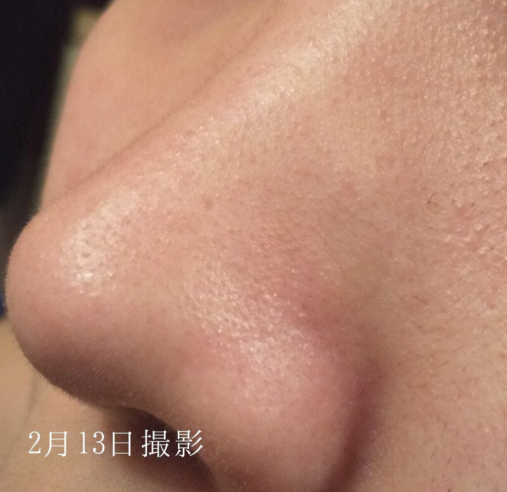 デュオ ザ クレンジングバーム クリア/DUO/クレンジングバームを使ったクチコミ(8枚目)