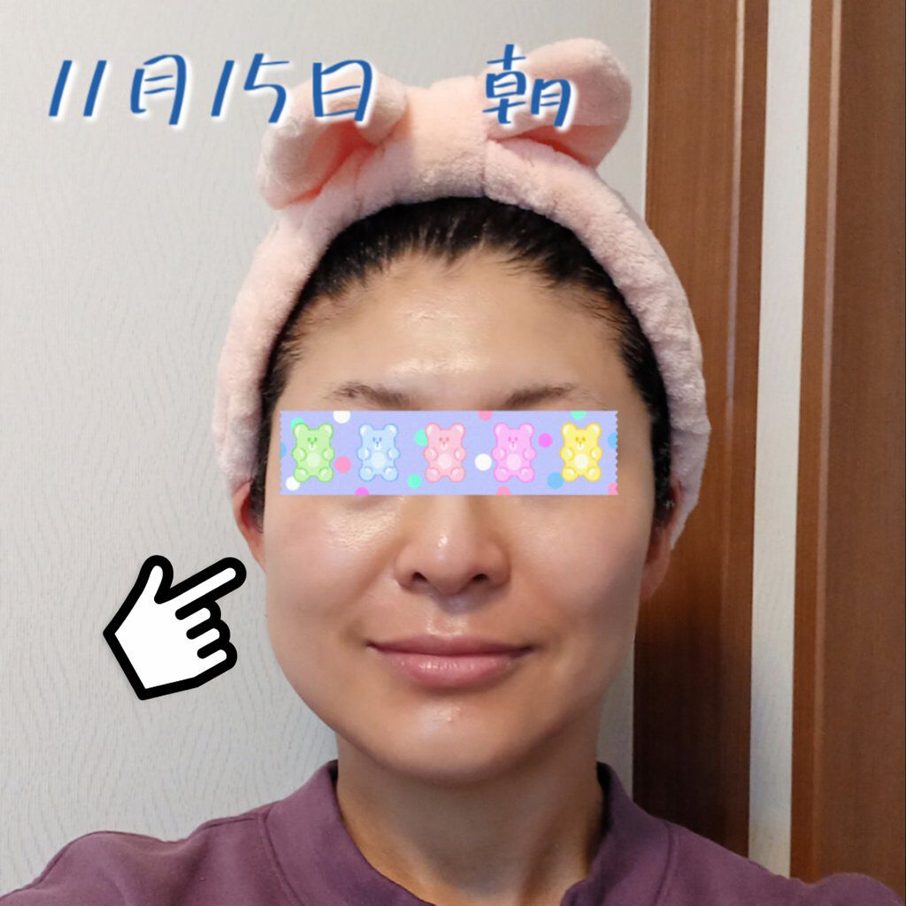 レチノールA 1% アドバンスドリバイタリゼーションクリーム/Life-flo/フェイスクリームを使ったクチコミ（1枚目）