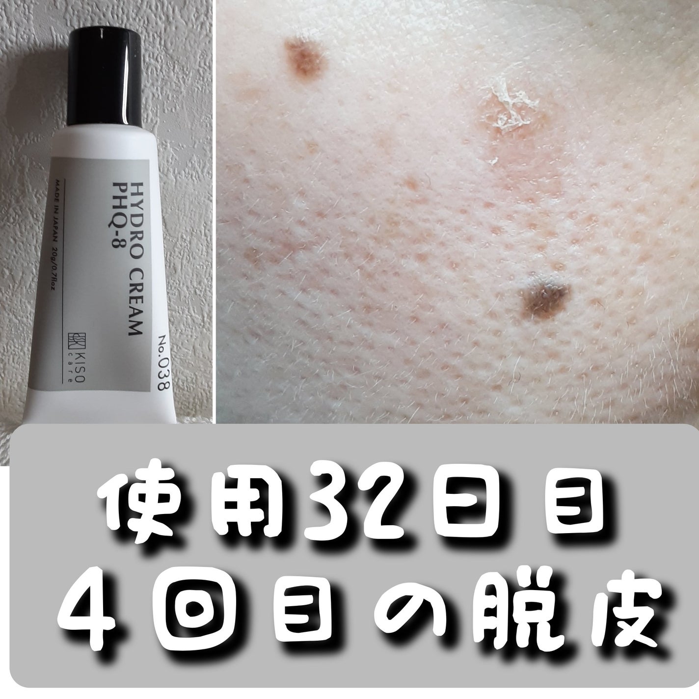 ハイドロクリームPHQ-8/KISO/美容液を使ったクチコミ(1枚目)