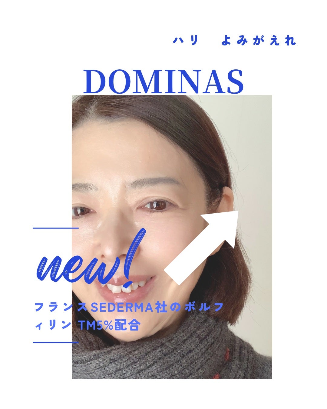 アットクリニック ボルフィリン リンクルショット アンプル/DOMINAS/美容液を使ったクチコミ(4枚目)