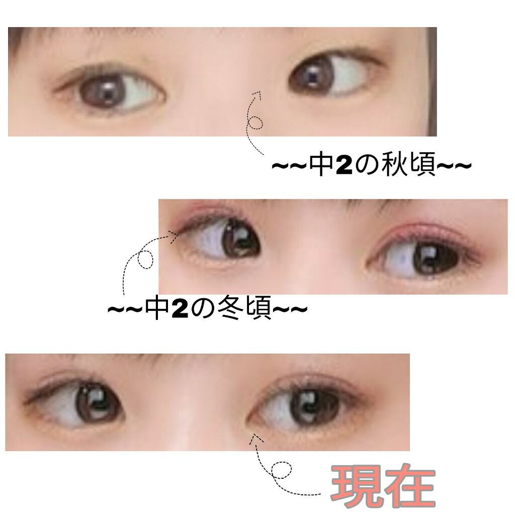 ダブルアイリキッド/Automatic Beauty/二重まぶた用アイテムを使ったクチコミ(2枚目)