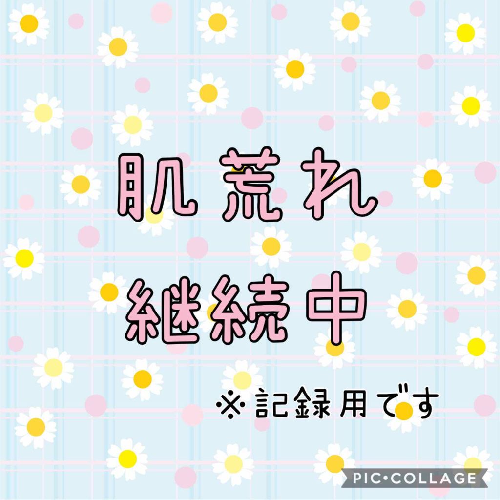 ねこになりたい。 on LIPS 「今の私の肌。3/13再アップ。レビューではなく記録用です、すみ..」(1枚目)