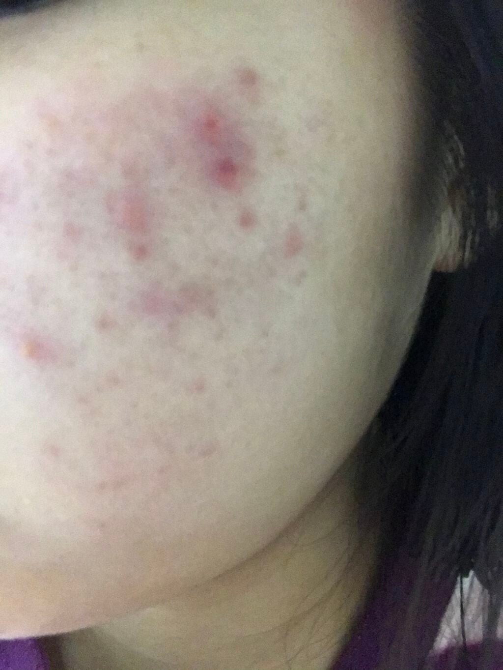 coral_make_3jl on LIPS 「⚠️汚い画像でほんとに申し訳ないです去年の4月ごろマスクをし出..」(1枚目)