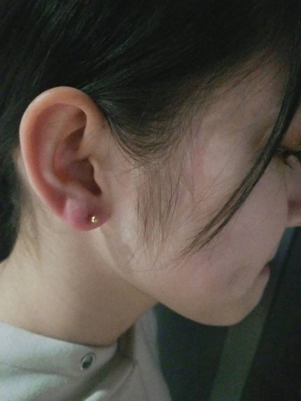 æè¯ðŠð¯ on LIPS ããä¹
ãã¶ãã§ãm(*__)mçªç¶ã§ãããã¢ã¹éããŸããã£ïŒð€(..ãïŒ1æç®ïŒ