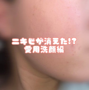 メンソレータム アクネス 薬用ふわふわな泡洗顔のクチコミ「ニキビに悩んでるならこの洗顔を買え

プチプラなのに効果抜群！

今までニキビに効く洗顔使って.....」（1枚目）