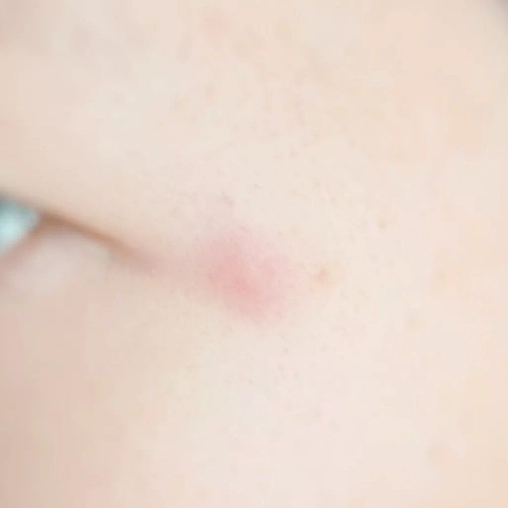 OK CICA CLEAR PATCH/GR/その他を使ったクチコミ(6枚目)