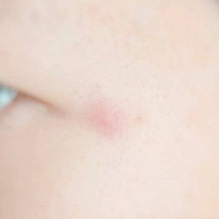 OK CICA CLEAR PATCH/GR/その他を使ったクチコミ(6枚目)