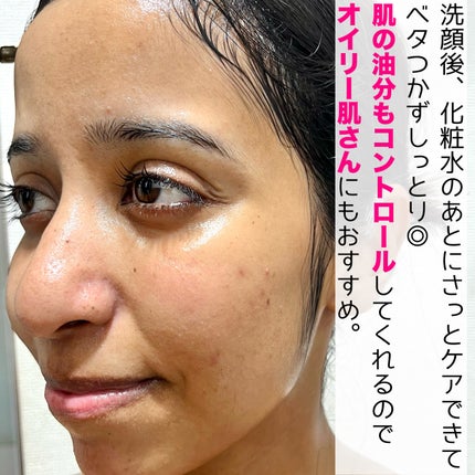 ノスカナイン トラブル セラム/FATION/美容液を使ったクチコミ(6枚目)