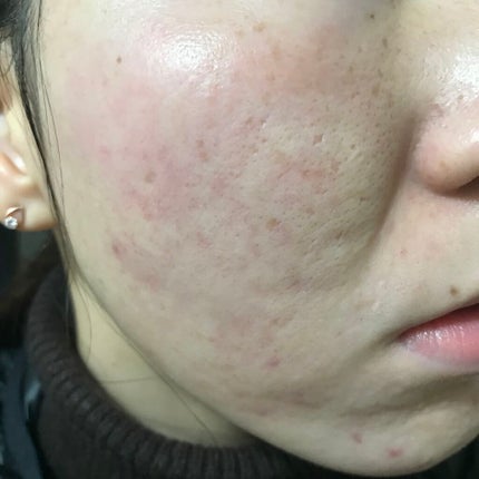 シルコット うるうるコットン/シルコット/コットンを使ったクチコミ(1枚目)