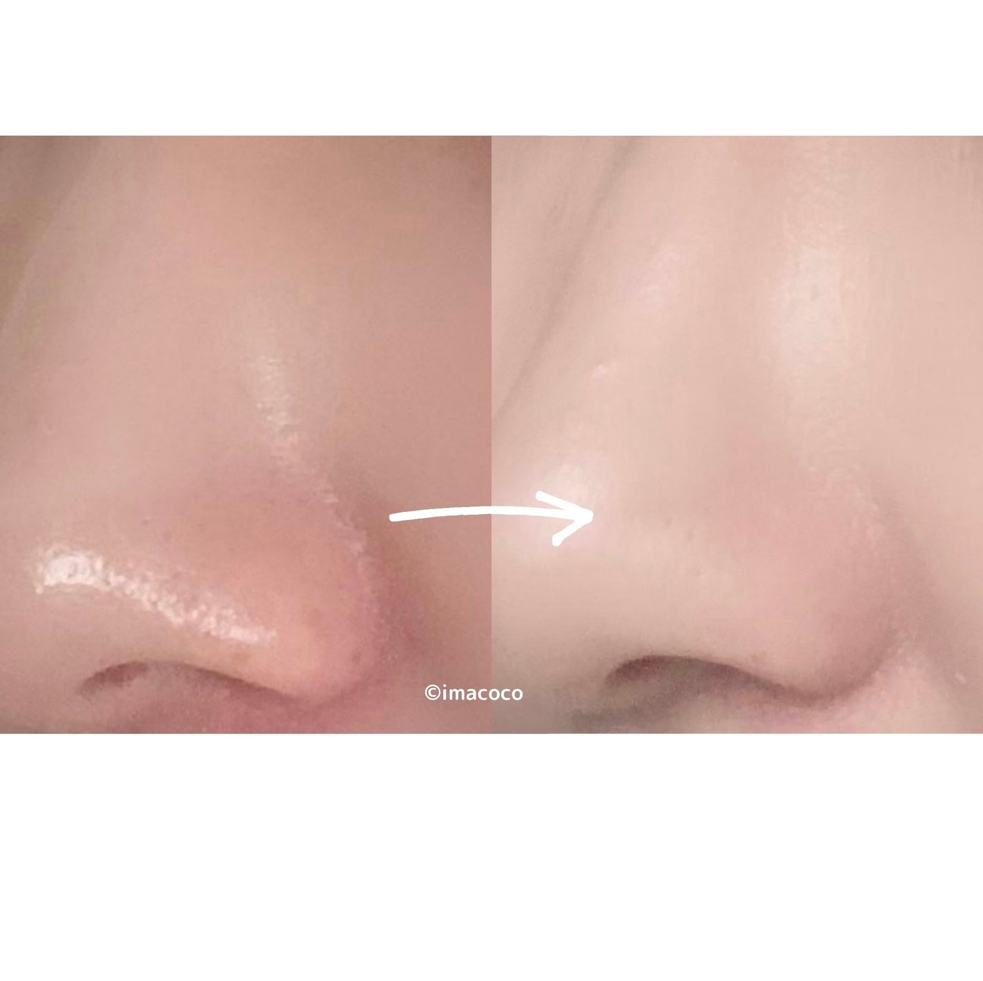 カバーパーフェクション チップコンシーラー/the SAEM/リキッドコンシーラーを使ったクチコミ(3枚目)