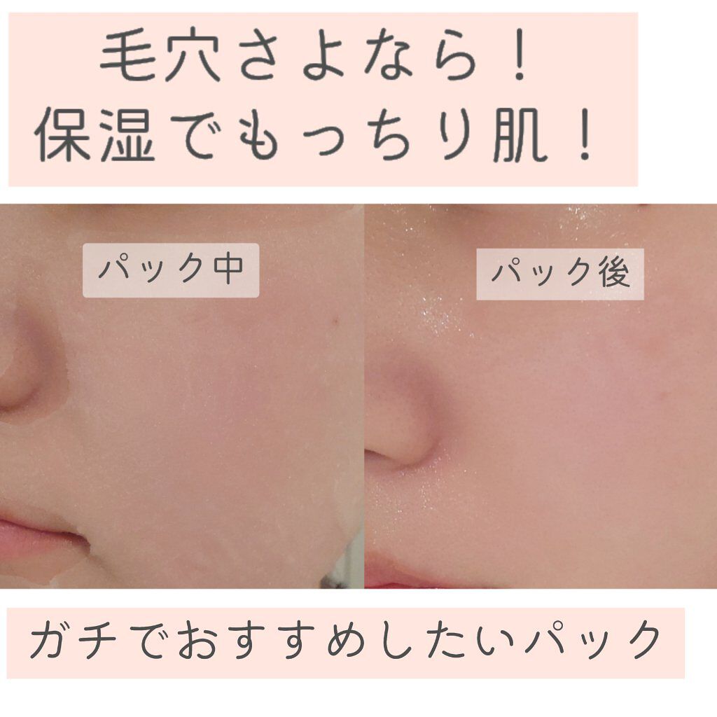 N.M.FアクアアンプルマスクJEX/MEDIHEAL/シートマスク・パックを使ったクチコミ（1枚目）