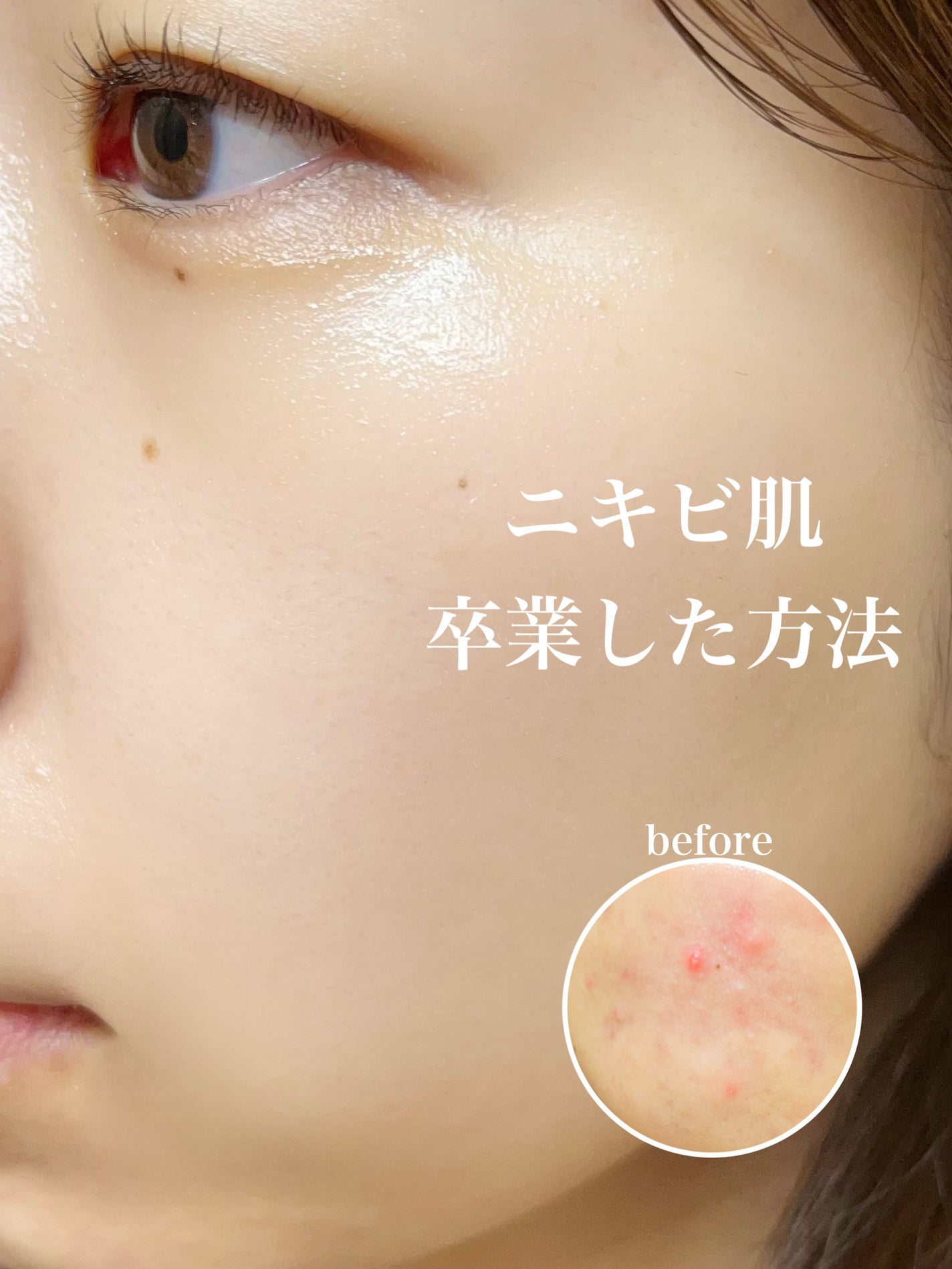 ヘルプミー! ダクトパッド/One-day's you/トナーパッドを使ったクチコミ(1枚目)