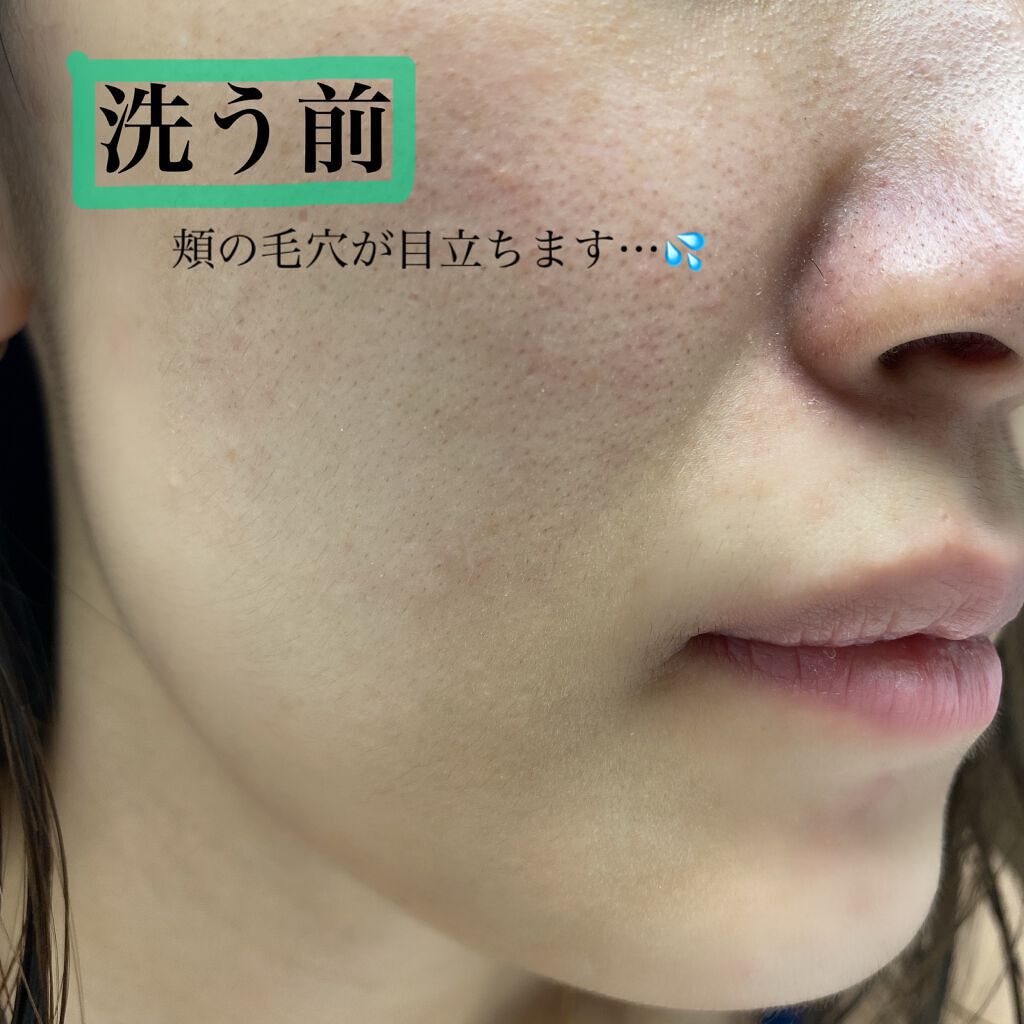 パワーマスク SP/ラッシュ/スクラブ・ゴマージュを使ったクチコミ(5枚目)