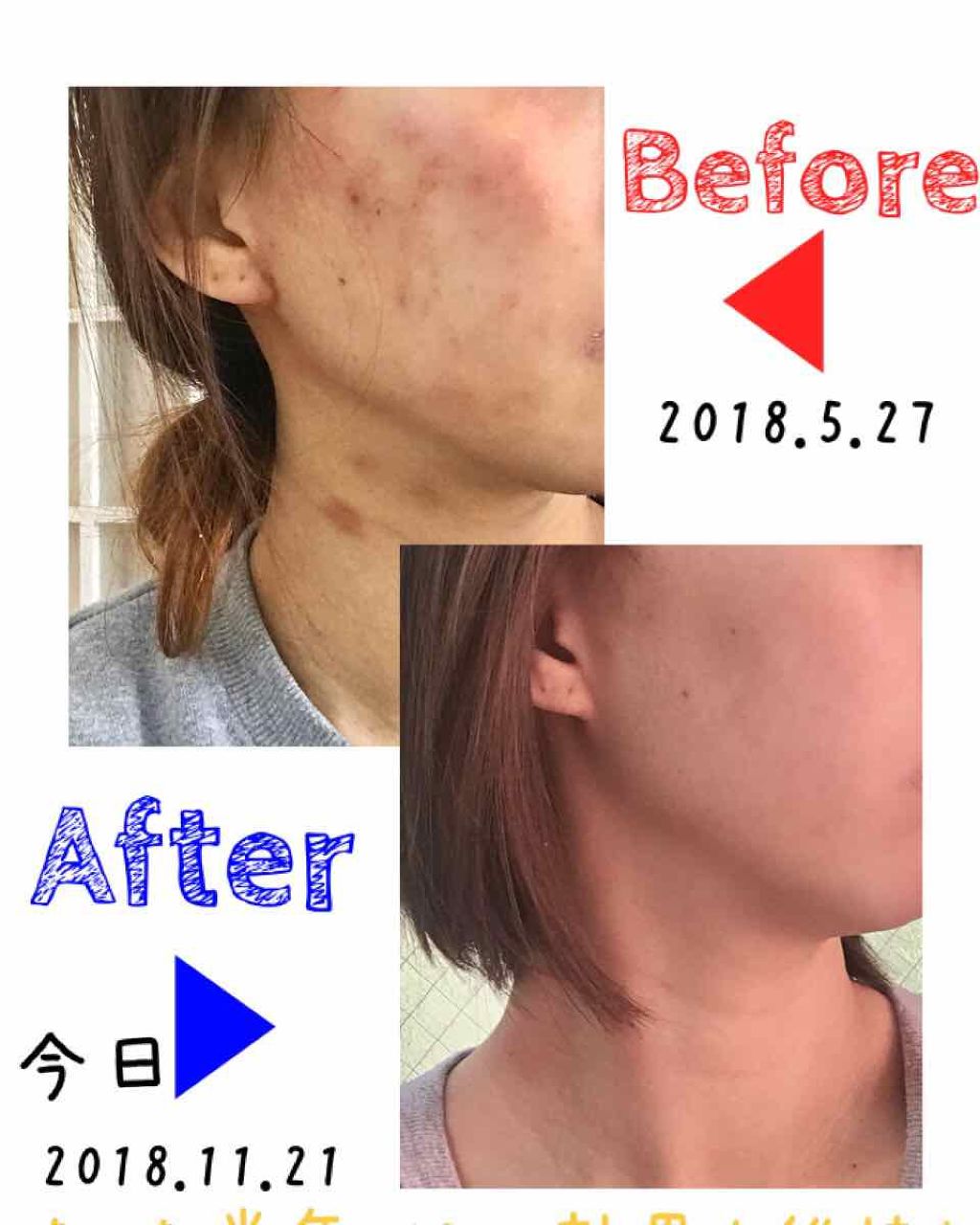 モイスト トリートメント ジェル/アルージェ/美容液を使ったクチコミ(3枚目)