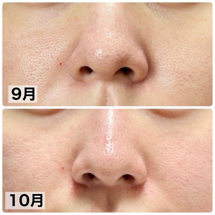 &be クレイウォッシュ/&be/洗顔フォームを使ったクチコミ(2枚目)