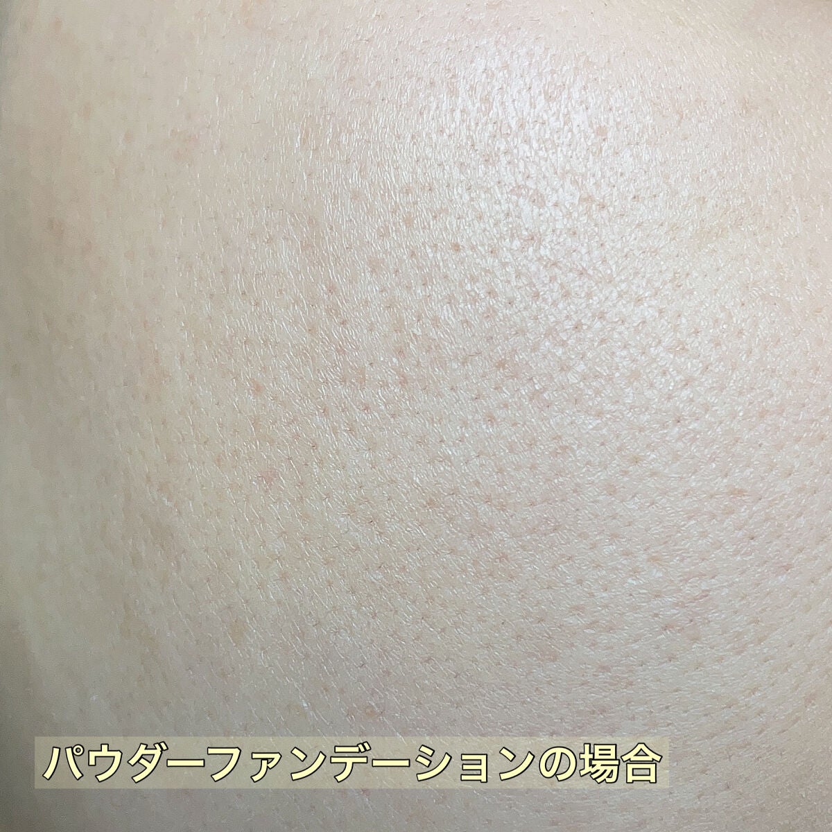 オイルコントロールカプセルエッセンス/celimax/美容液を使ったクチコミ(5枚目)