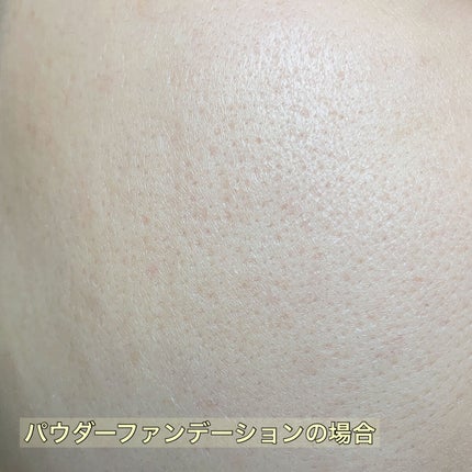 オイルコントロールカプセルエッセンス/celimax/美容液を使ったクチコミ(5枚目)