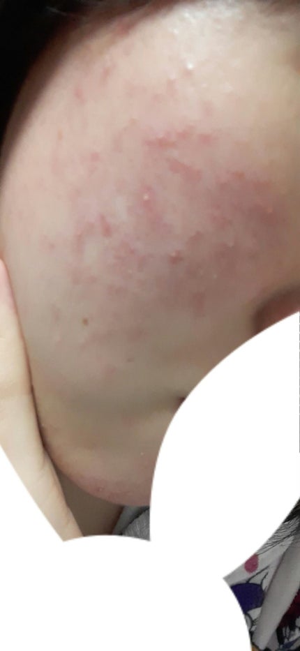 を使ったクチコミ(2枚目)