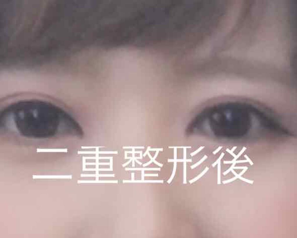 ブリッジファイバー 1.8mm/FD(エフディ)/二重まぶた用アイテムを使ったクチコミ(2枚目)