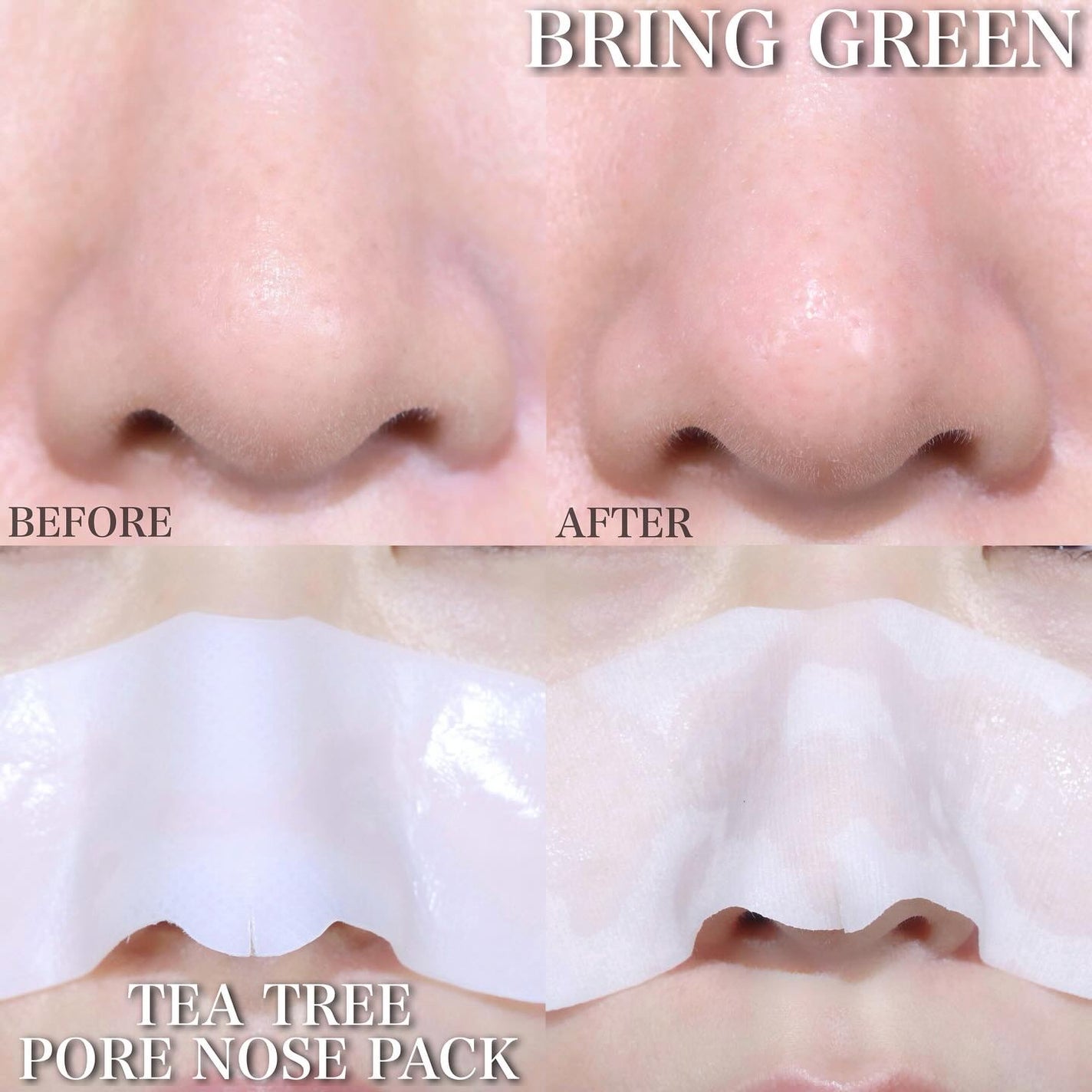 ティーツリーシカスージングトナー/BRING GREEN/化粧水を使ったクチコミ(9枚目)