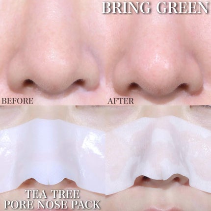 ティーツリーシカスージングトナー/BRING GREEN/化粧水を使ったクチコミ(9枚目)
