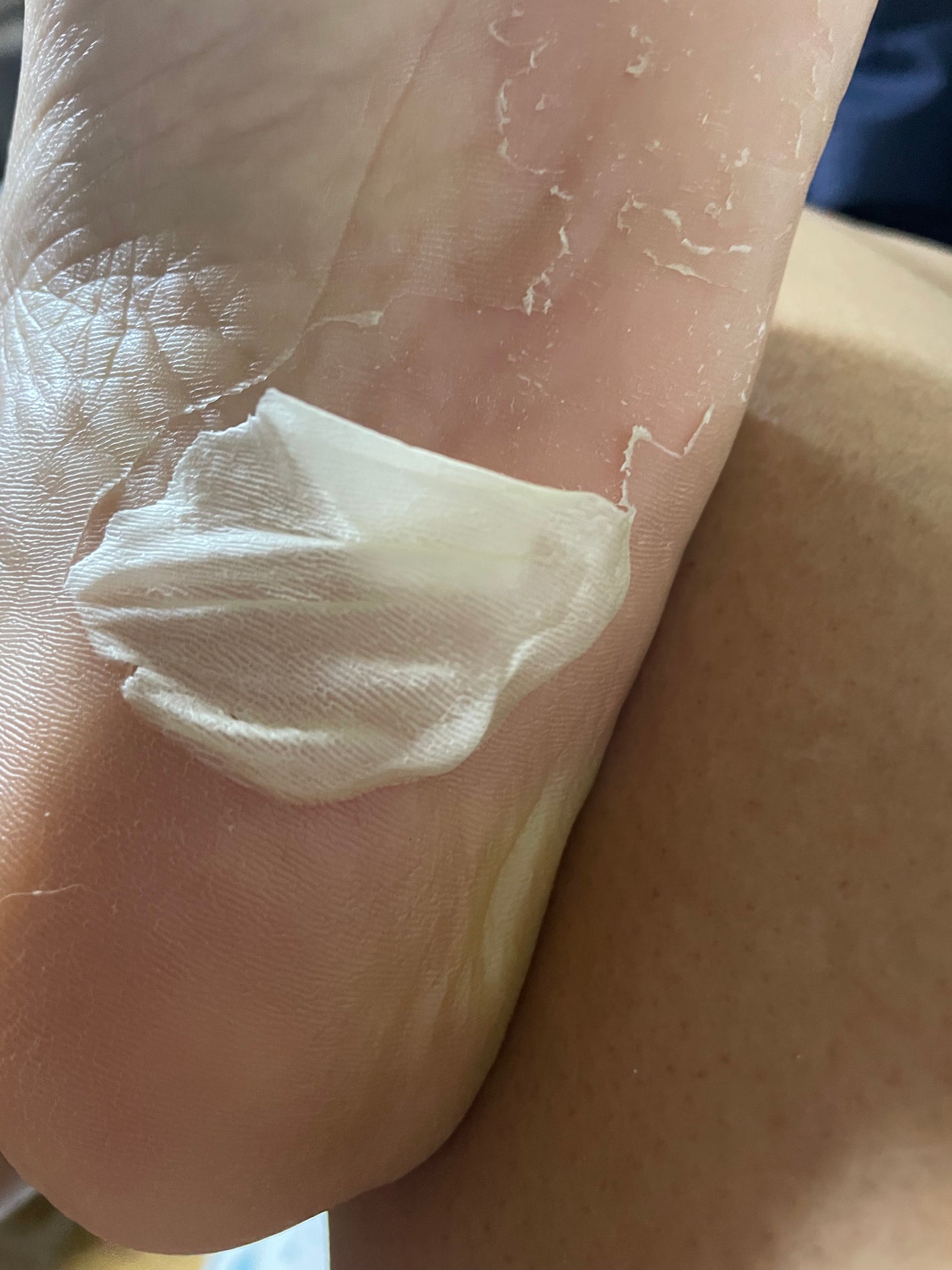 かかと どうスルん??そうスルんDX/Stay Free/レッグ・フットケアを使ったクチコミ(4枚目)