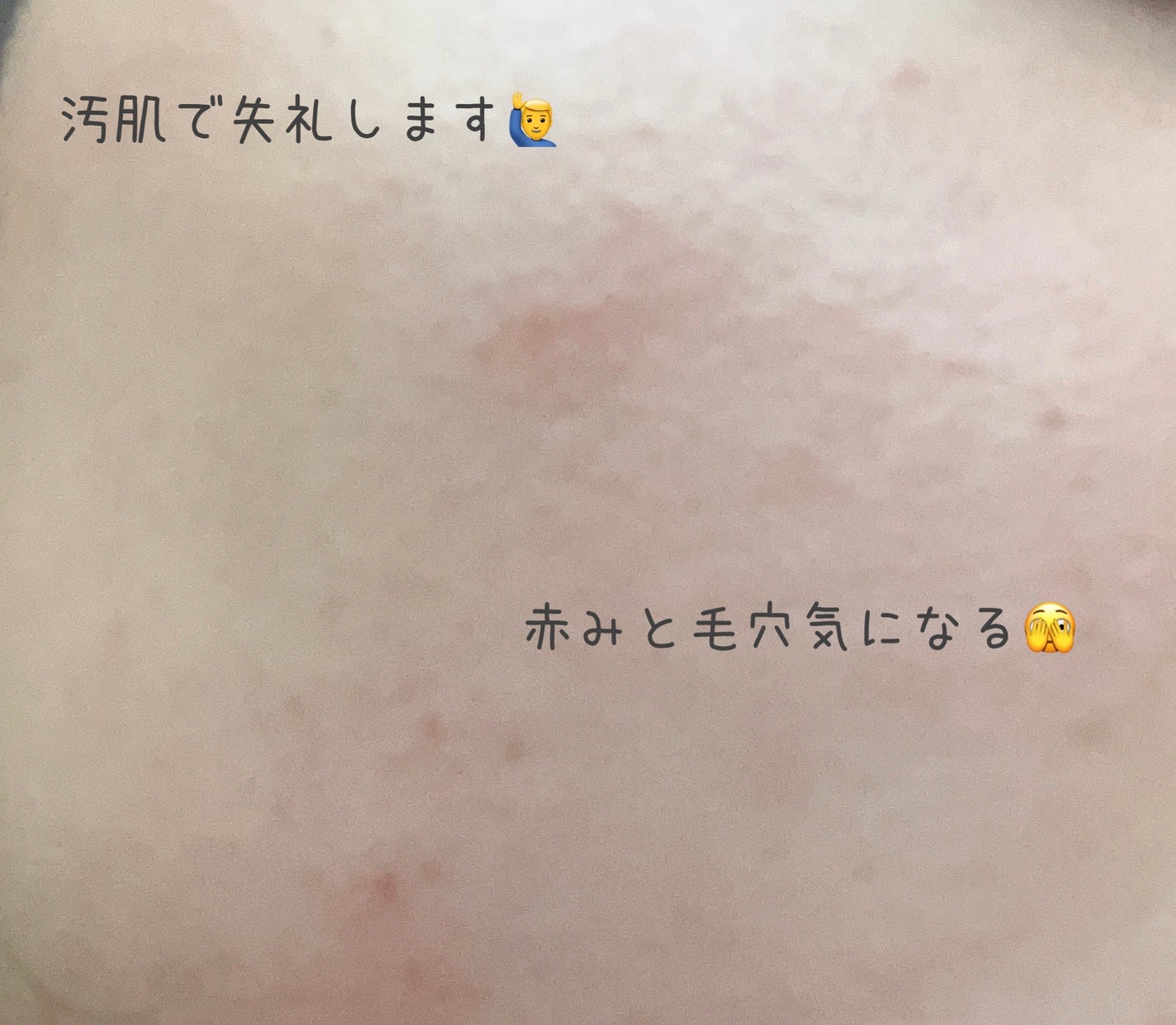 ピンクティーツリーカバークッション/APLIN/クッションファンデーションを使ったクチコミ(5枚目)