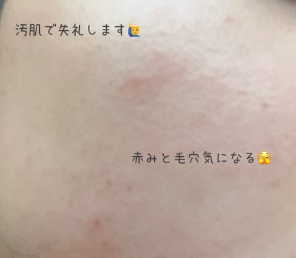 ピンクティーツリーカバークッション/APLIN/クッションファンデーションを使ったクチコミ(5枚目)