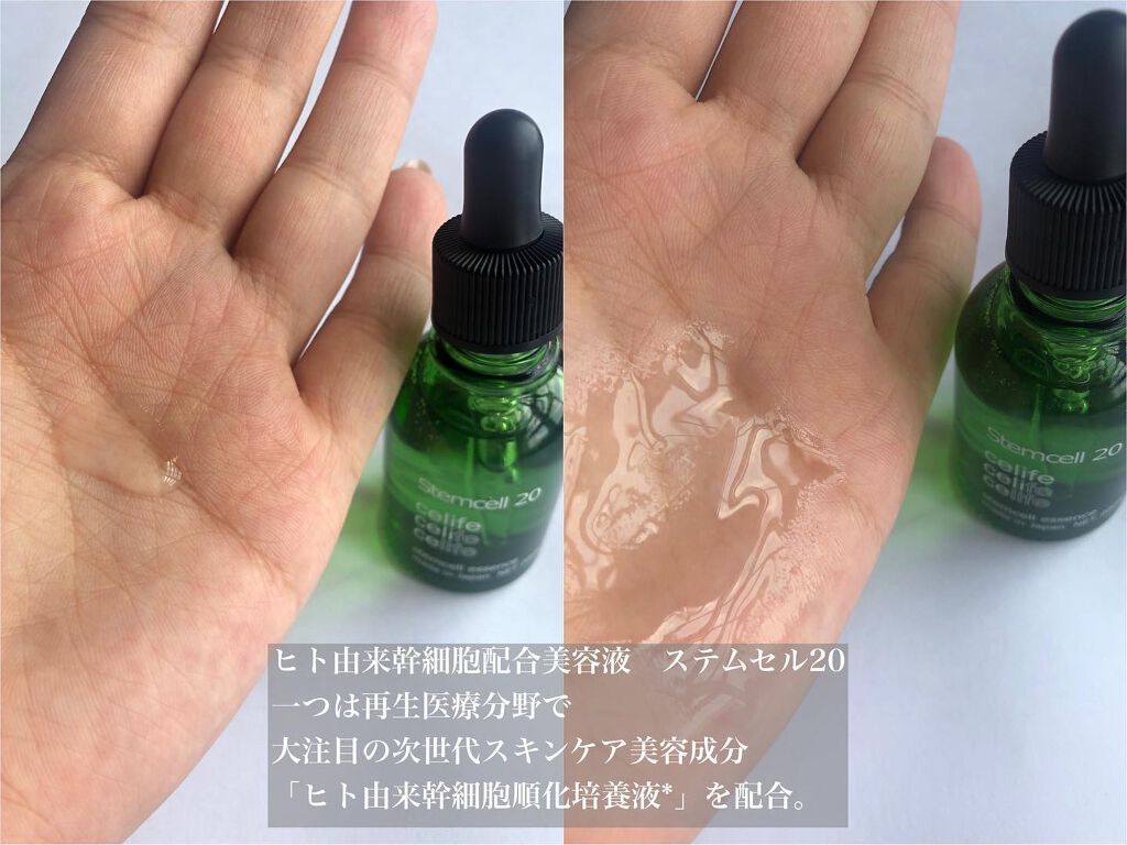 ヒト由来幹細胞美容液 ステムセル20/Celife/美容液を使ったクチコミ(3枚目)