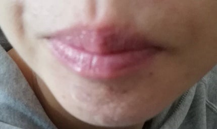 YNM キャンディーハニーリップバーム/YNM/リップバームを使ったクチコミ(5枚目)