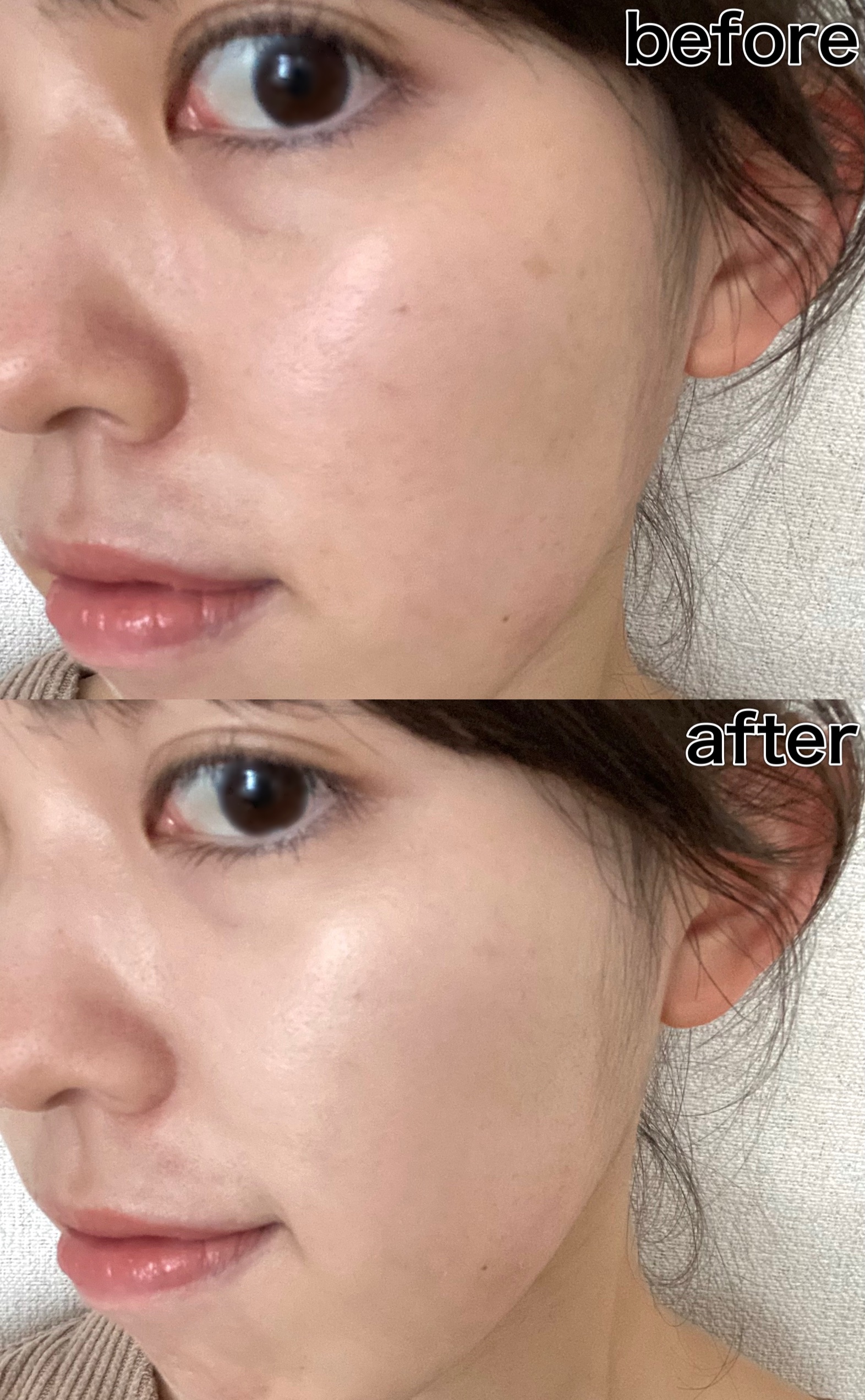 ダーマシンコンシーラー/23years old/リキッドコンシーラーを使ったクチコミ（3枚目）