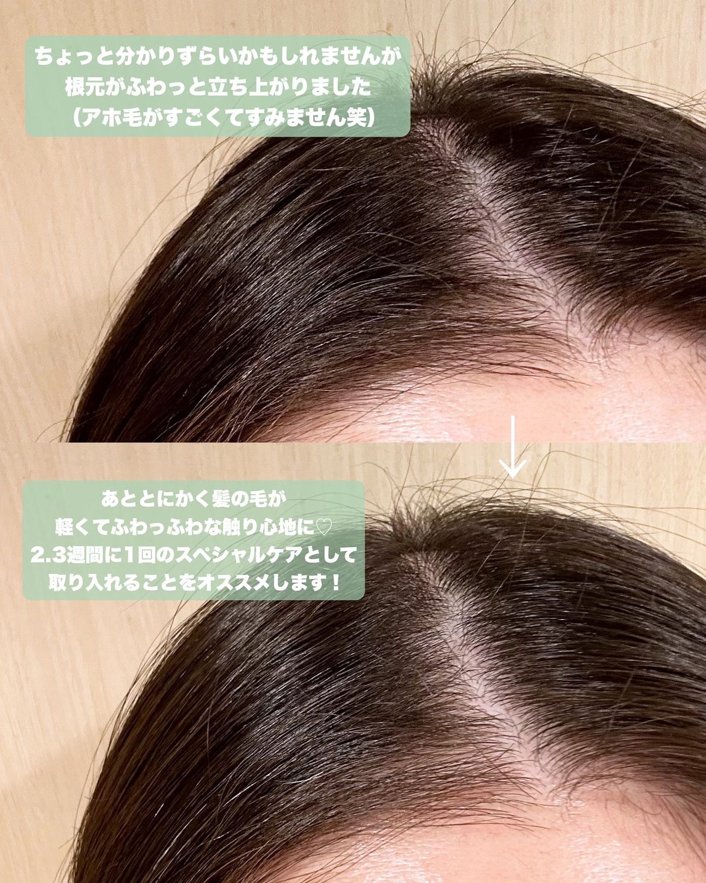 スパークリングスカルプスケーラー/ミンツリー/頭皮ケアを使ったクチコミ(5枚目)