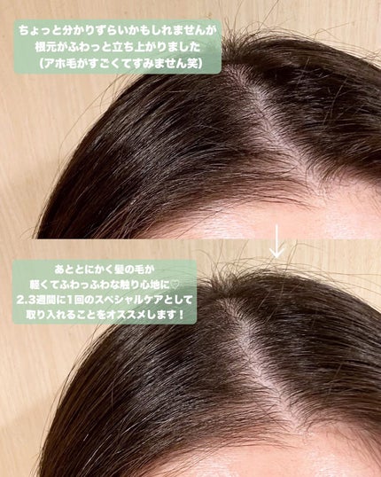 スパークリングスカルプスケーラー/ミンツリー/頭皮ケアを使ったクチコミ(5枚目)