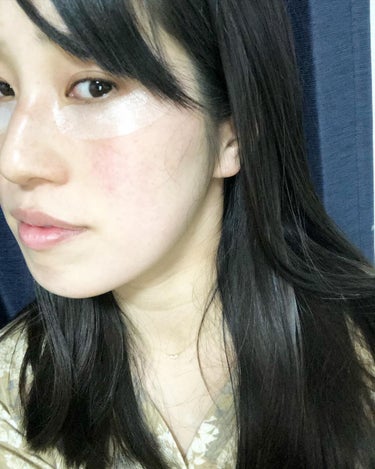 めぐみ on LIPS 「クラブリクエスコンセントレートチャージパッチ貼って寝るだけのス..」（2枚目）