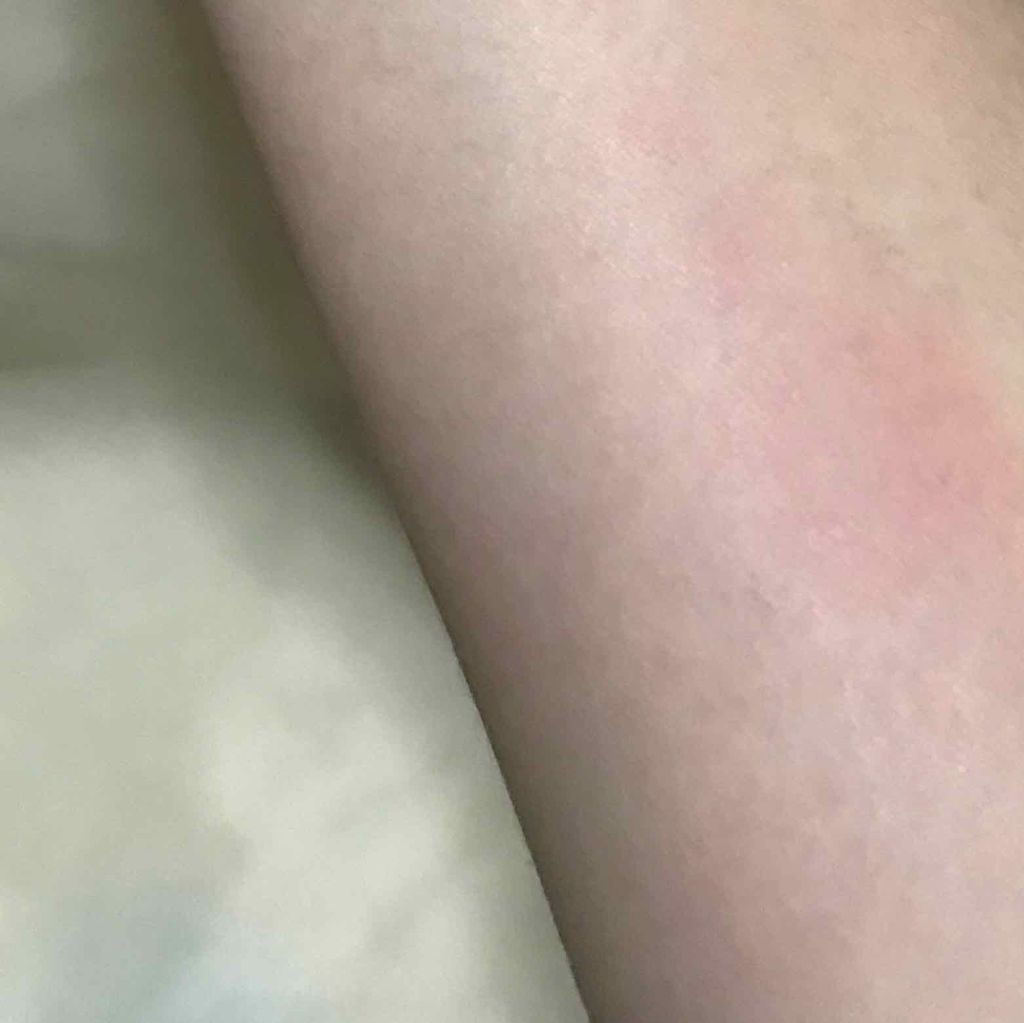 AT メイク直しペン/Art Collection/ポイントメイクリムーバーを使ったクチコミ(3枚目)