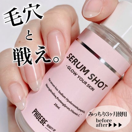 セラムショット N/PHOEBE BEAUTY UP/美容液を使ったクチコミ(1枚目)